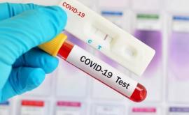  В Молдову поступят еще 100 000 тестов на COVID19