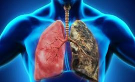 Alimentul care ucide 85 din celulele cancerului pulmonar