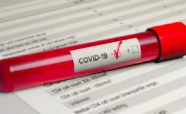 Красный код COVID19 объявлен в двух населенных пунктах страны