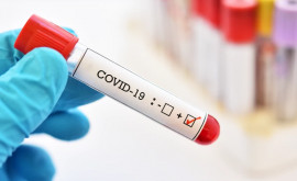 Ministerul Sănătății În ultima săptămînă media cazurilor COVID19 a crescut cu 50