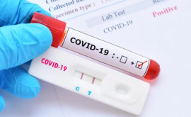 В Молдове зарегистрировали 2057 новых случаев COVID19