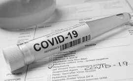 В Молдове зарегистрировали 1573 новых случая COVID19