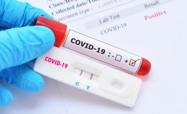 В Молдове за последние сутки у 1487 человек диагностировали коронавирус