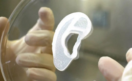 Врачи пересаживают напечатанное на 3Dпринтере ухо из клеток человека