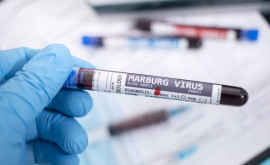 Boala necunoscută din Tanzania sa dovedit a fi un virus extrem de periculos 