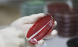 В ЛосАнджелесе впервые обнаружили устойчивые к антибиотикам бактерии