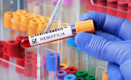Astăzi este marcată Ziua mondială a hemofiliei Cîți pacienți suferă de această maladie în Moldova