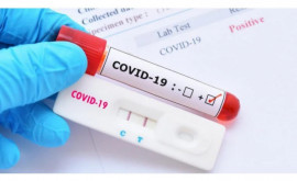 В Молдове зарегистрировано более 70 новых случаев заболевания COVID19