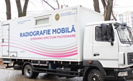 Servicii gratuite de screening pulmonar în raionul Orhei