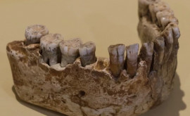 În urmă cu 8000 de ani existau dentiști