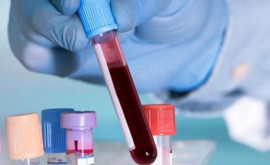Primul test de sînge din lume pentru depistarea cancerului cerebral dă noi speranțe de viață