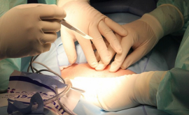 Проведена первая в мире пересадка головы человека