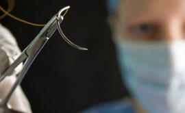 Acul chirurgical inteligent care oferă imaginile organelor în timpul operației