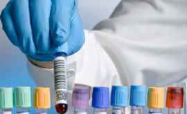 Analiza de sînge care depistează pînă la 8 tipuri de cancer