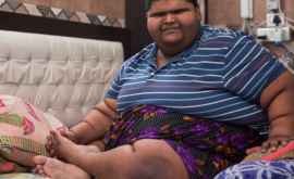 Cel mai gras copil din lume a început să slăbească FOTO