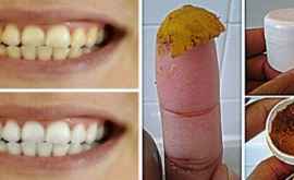 Сам себе стоматолог лечите кариес и отбеливайте зубы этой натуральной зубной пастой