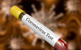 Ministerul Sănătății preîntîmpină populația privind testele false pentru coronavirus