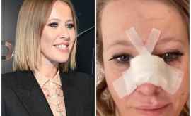 Prezentatoarea TV Xenia Sobceak șia rupt nasul și a ajuns la spital