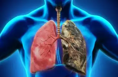 Alimentul care ucide 85% din celulele cancerului pulmonar